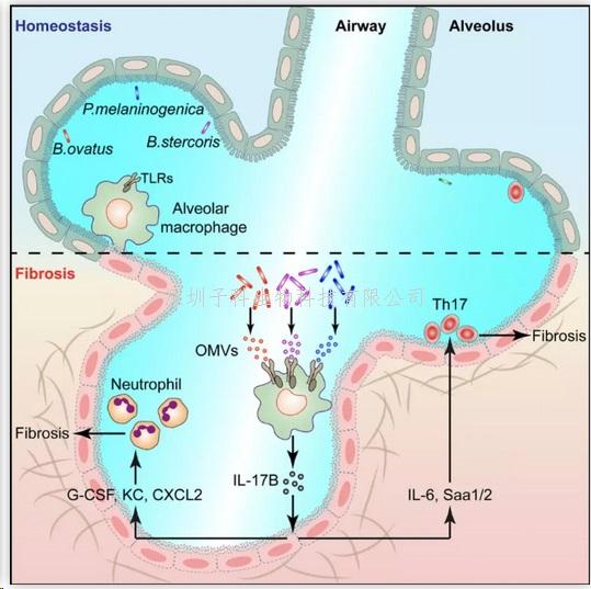Immunity：錢友存團(tuán)隊(duì)發(fā)現(xiàn)肺纖維化疾病的分子機(jī)制