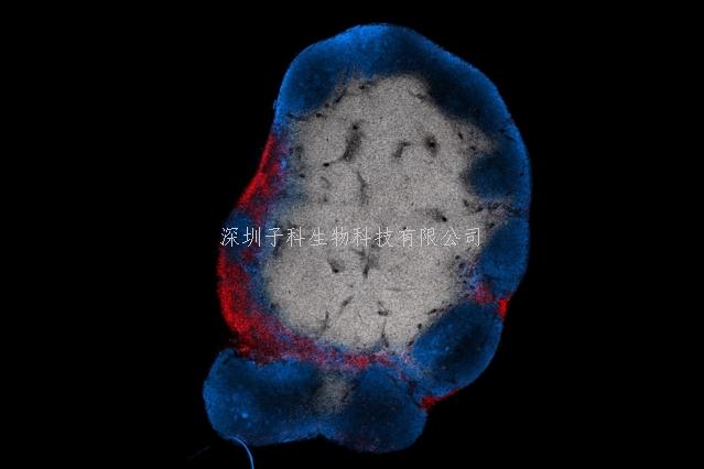 頭腦風(fēng)暴: 讓CAR-T變身微型藥庫 成功清除小鼠膠質(zhì)母細(xì)胞瘤