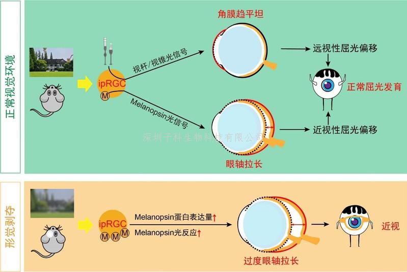楊雄里院士團隊揭示自感光視網(wǎng)膜神經(jīng)節(jié)細胞在近視形成中的重要作用